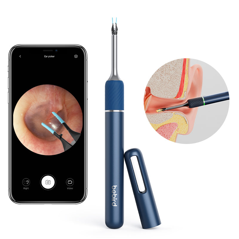 Blue ear cleaning tool with smartphone displaying ear inspection app and close-up of ear canal.