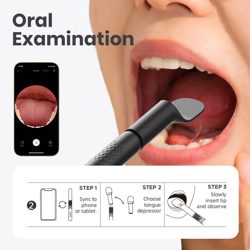 Oral examination tool with smartphone app for dental inspection