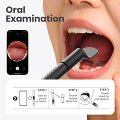 Oral examination tool with smartphone app for dental inspection