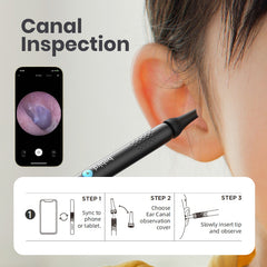 Ear inspection tool with smartphone app displaying ear canal image, steps for use, and close-up of ear.